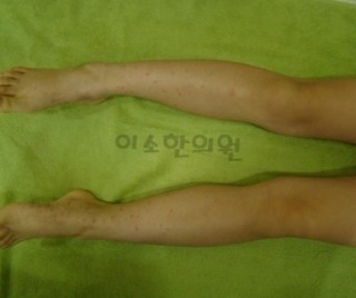 ㅈㅈㅇ_자반_전 (2)