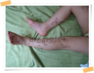 Re_ㅅㅌㅇ_자반_전_양_다리