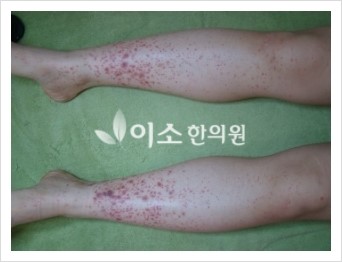 ㄱㅂㄹ_20대_여성_자반_전 (1)