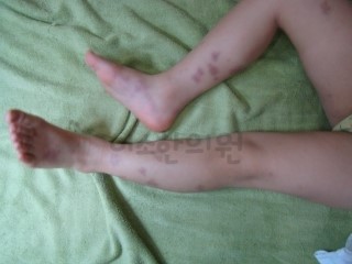 ㅅㅌㅇ_자반_전_양_다리