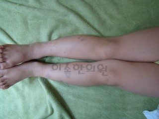 ㅅㅌㅇ_자반_전면부_전