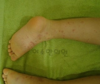 ㅈㅈㅇ_자반_전_좌측_다리_후면