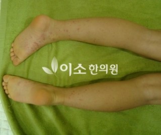 ㅈㅈㅇ_자반_전_후면