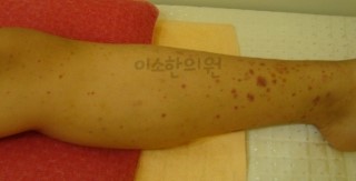 ㅈㅈㅎ_자반_전