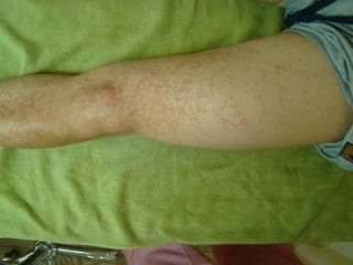 고추가루_타입_2