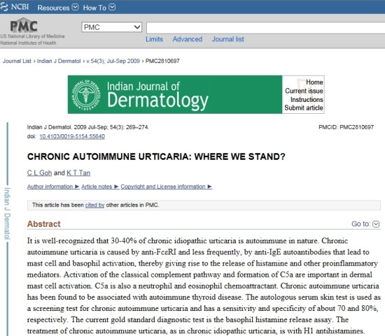 자가면역_두드러기