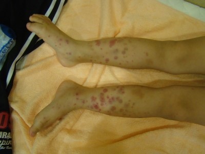 직경이_넓은_자반2