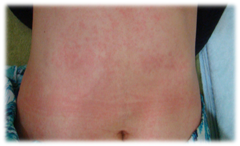 SHH_post_160704_img02