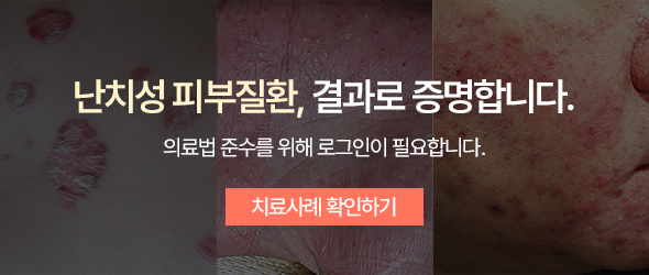 치료사례 로그인 필요