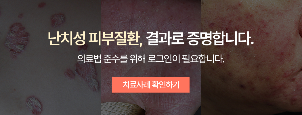 치료사례 로그인 필요