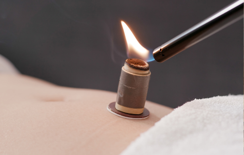 뜸을 놓는 모습