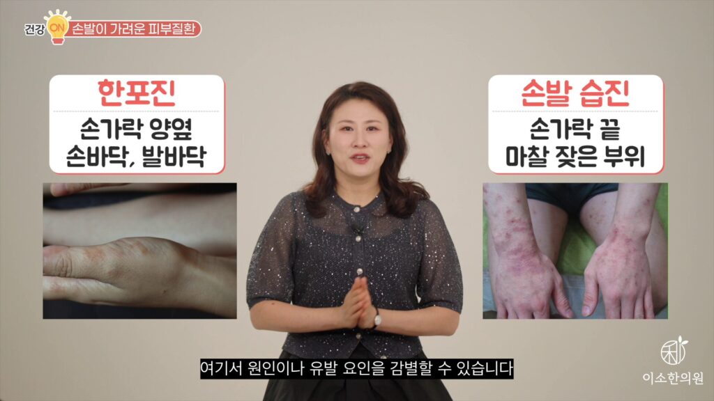 증상 부위로 원인이나 유발 요인을 감별할 수 있습니다.