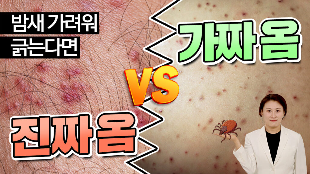 진짜 옴 VS 가짜 옴