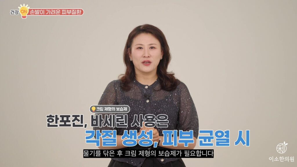 한포진, 바세린 사용은 각질 생성, 피부 균열 시