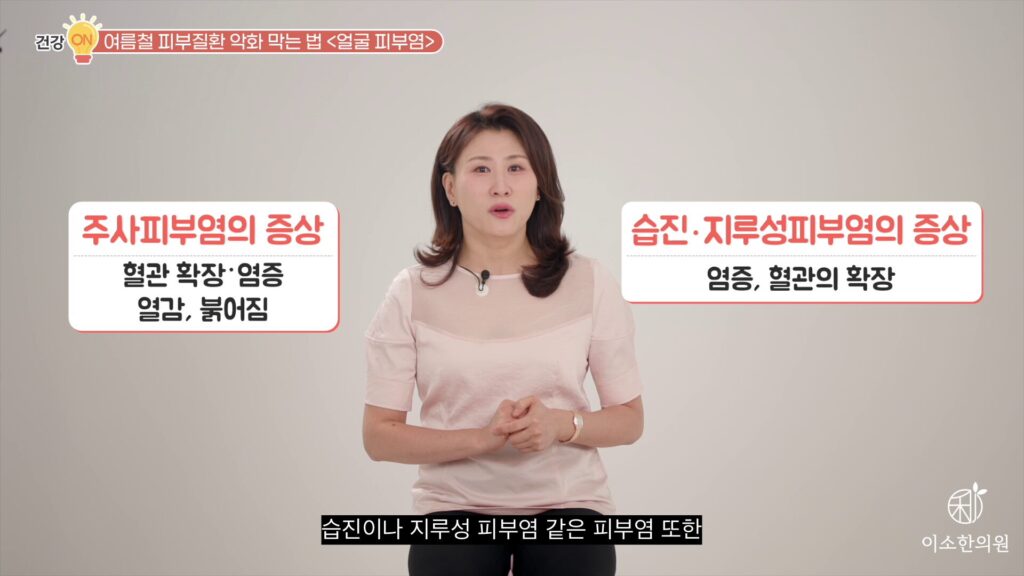 주사피부염의 증상, 습진, 지루성 피부염의 증상