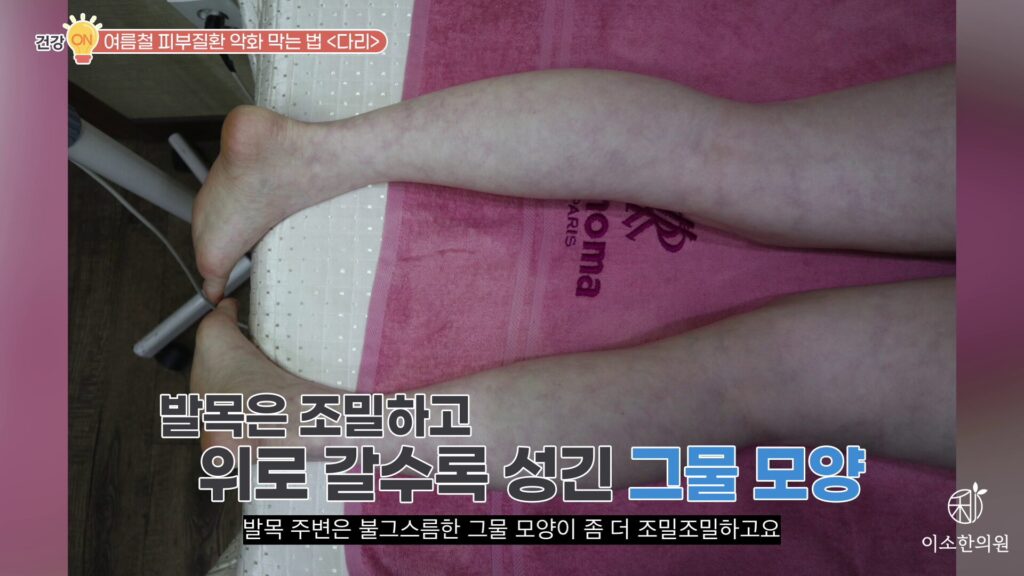 전형적인 망상청피반
