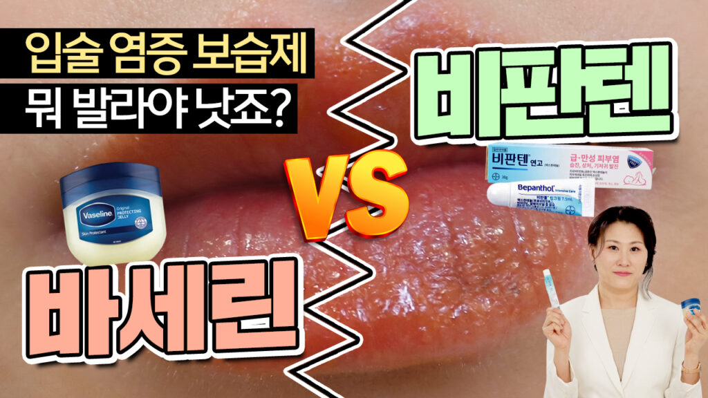 바세린 VS 비판텐