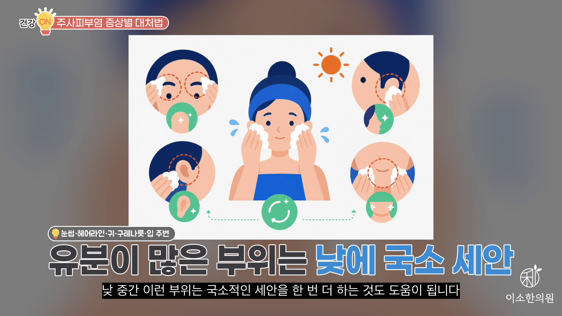 유뷴이 많은 부위는 낮에 국소 세안