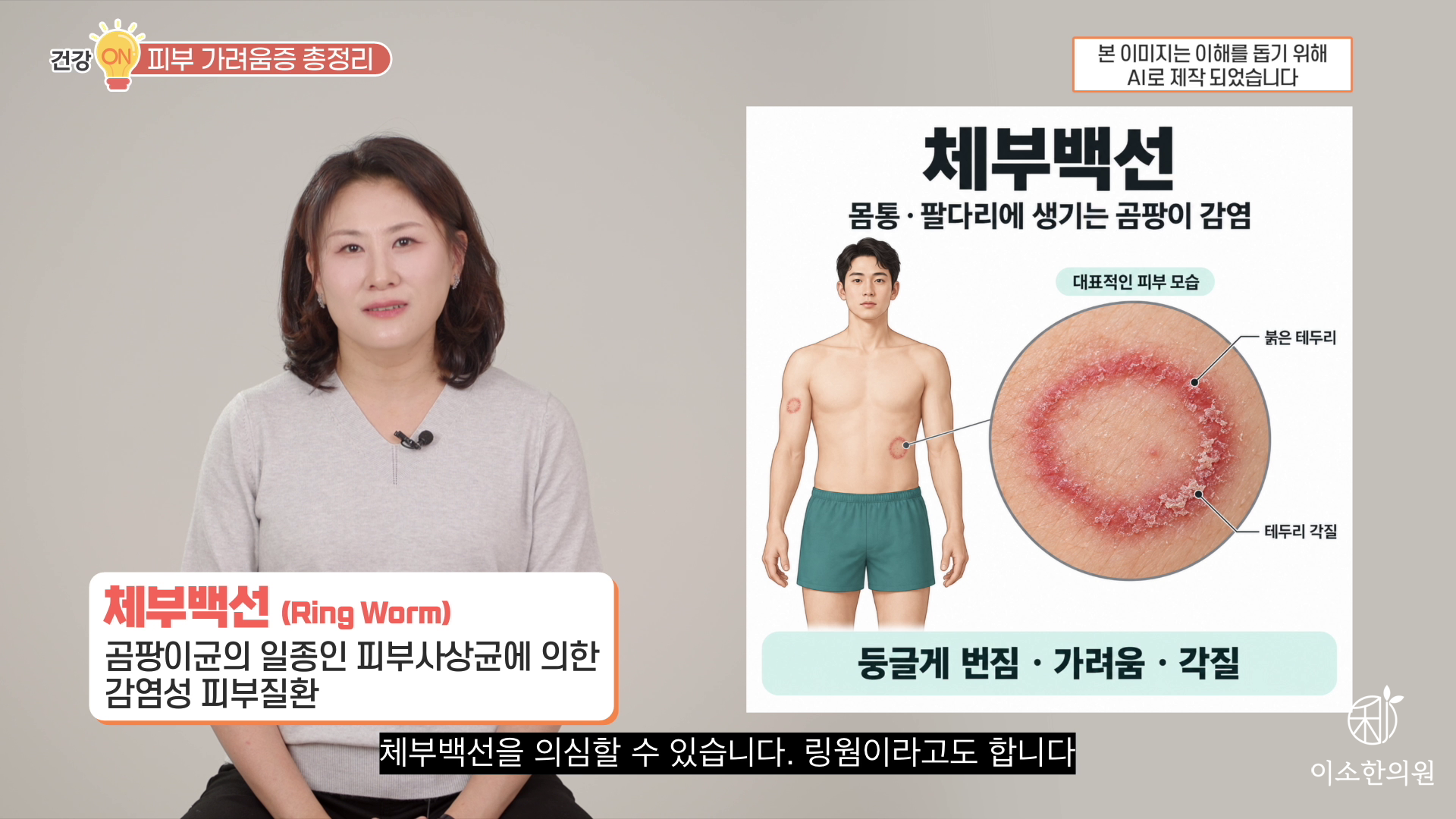 체부백선