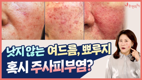 관련 유튜브 동영상으로 연결