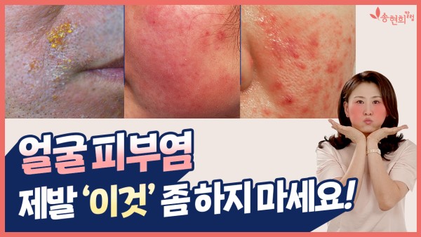 유튜브 영상으로 이동